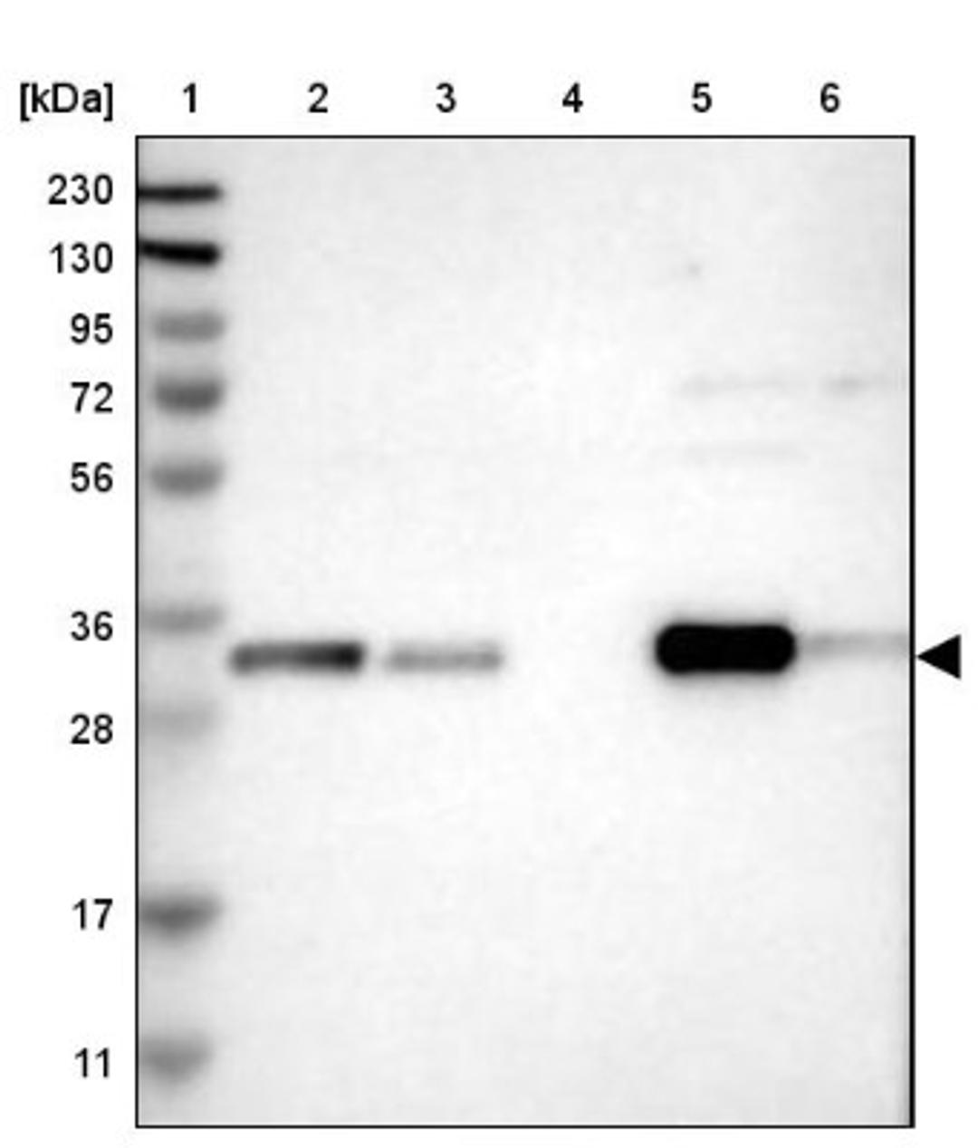 Western Blot: CBR1 Antibody [NBP1-86595] - Lane 1: Marker [kDa] 230, 130, 95, 72, 56, 36, 28, 17, 11<br/>Lane 2: Human cell line RT-4<br/>Lane 3: Human cell line U-251MG sp<br/>Lane 4: Human plasma (IgG/HSA depleted)<br/>Lane 5: Human liver tissue<br/>Lane 6: Human tonsil tissue