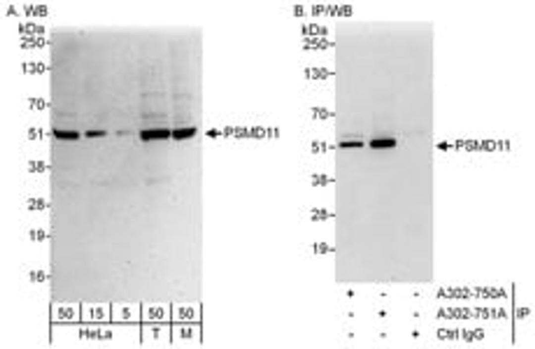 Detection of human and mouse PSMD11 by western blot (h&m) and immunoprecipitation (h).