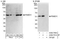 Detection of human and mouse PSMD11 by western blot (h&m) and immunoprecipitation (h).