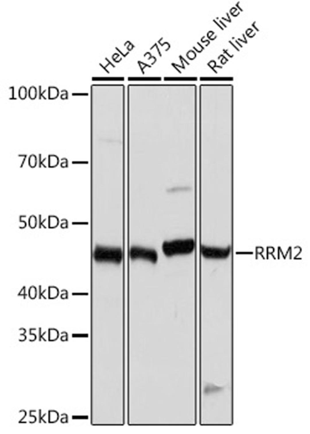 Western blot - RRM2 Rabbit mAb (A3424)
