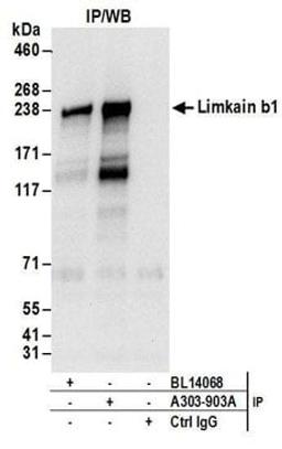 Detection of human Limkain b1 by western blot of immunoprecipitates.