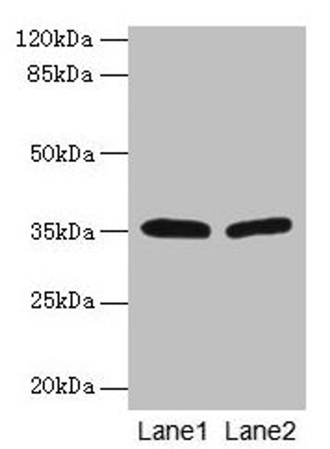 Western blot. All lanes: HSD17B12 antibody at 1.2µg/ml. Lane 1: U251 whole cell lysate. Lane 2: A431 whole cell lysate. Secondary. Goat polyclonal to rabbit IgG at 1/10000 dilution. Predicted band size: 35, 11 kDa. Observed band size: 35 kDa