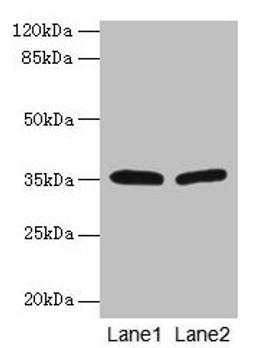Western blot. All lanes: HSD17B12 antibody at 1.2µg/ml. Lane 1: U251 whole cell lysate. Lane 2: A431 whole cell lysate. Secondary. Goat polyclonal to rabbit IgG at 1/10000 dilution. Predicted band size: 35, 11 kDa. Observed band size: 35 kDa