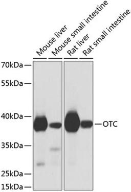 Western blot - OTC antibody (A9834)