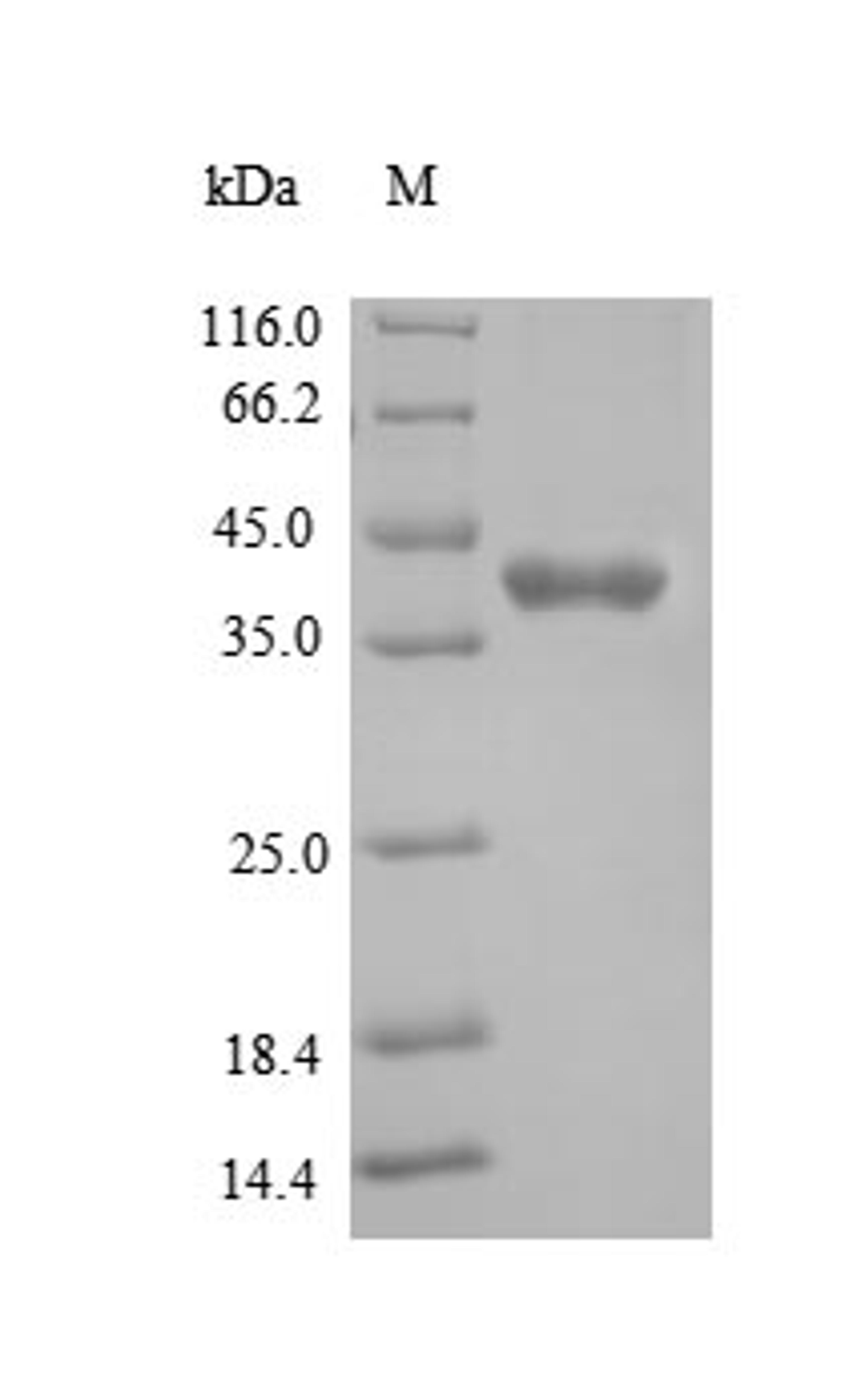 (Tris-Glycine gel) Discontinuous SDS-PAGE (reduced) with 5% enrichment gel and 15% separation gel.