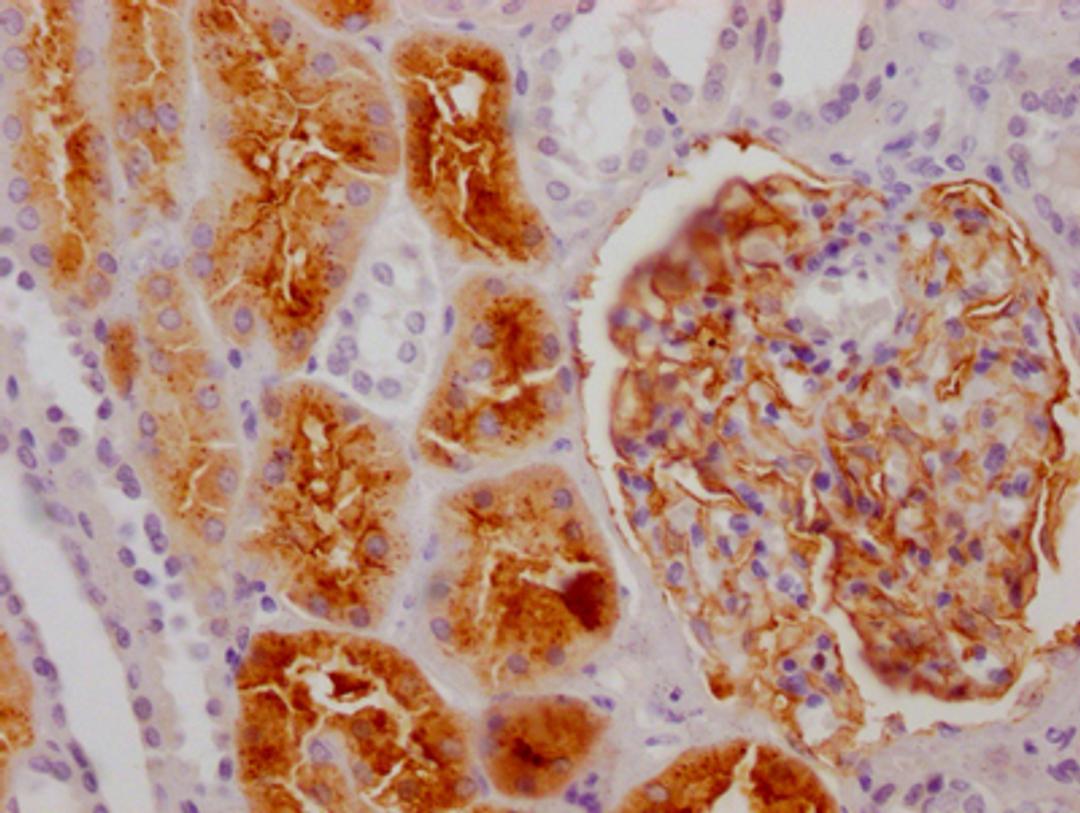 IHC image of CSB-RA552900A0HU diluted at 1:100 and staining in paraffin-embedded human kidney tissue performed on a Leica BondTM system. After dewaxing and hydration, antigen retrieval was mediated by high pressure in a citrate buffer (pH 6.0). Section was blocked with 10% normal goat serum 30min at RT. Then primary antibody (1% BSA) was incubated at 4℃ overnight. The primary is detected by a Goat anti-rabbit IgG polymer labeled by HRP and visualized using 0.05% DAB.