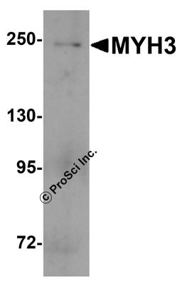 Western blot analysis of MYH3 in fetal human skeletal muscle lysate with MYH3 antibody at 1 μg/ml.