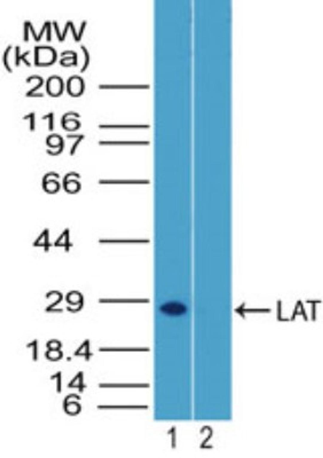 Western Blot: LAT Antibody [NBP2-27104] - analysis of LAT in mouse thymus tissue lysate in the 1) absence and 2) presence of immunizing peptide using this antibody. I goat anti-rabbit Ig HRP secondary antibody and PicoTect ECL substrate solution were used for this test.