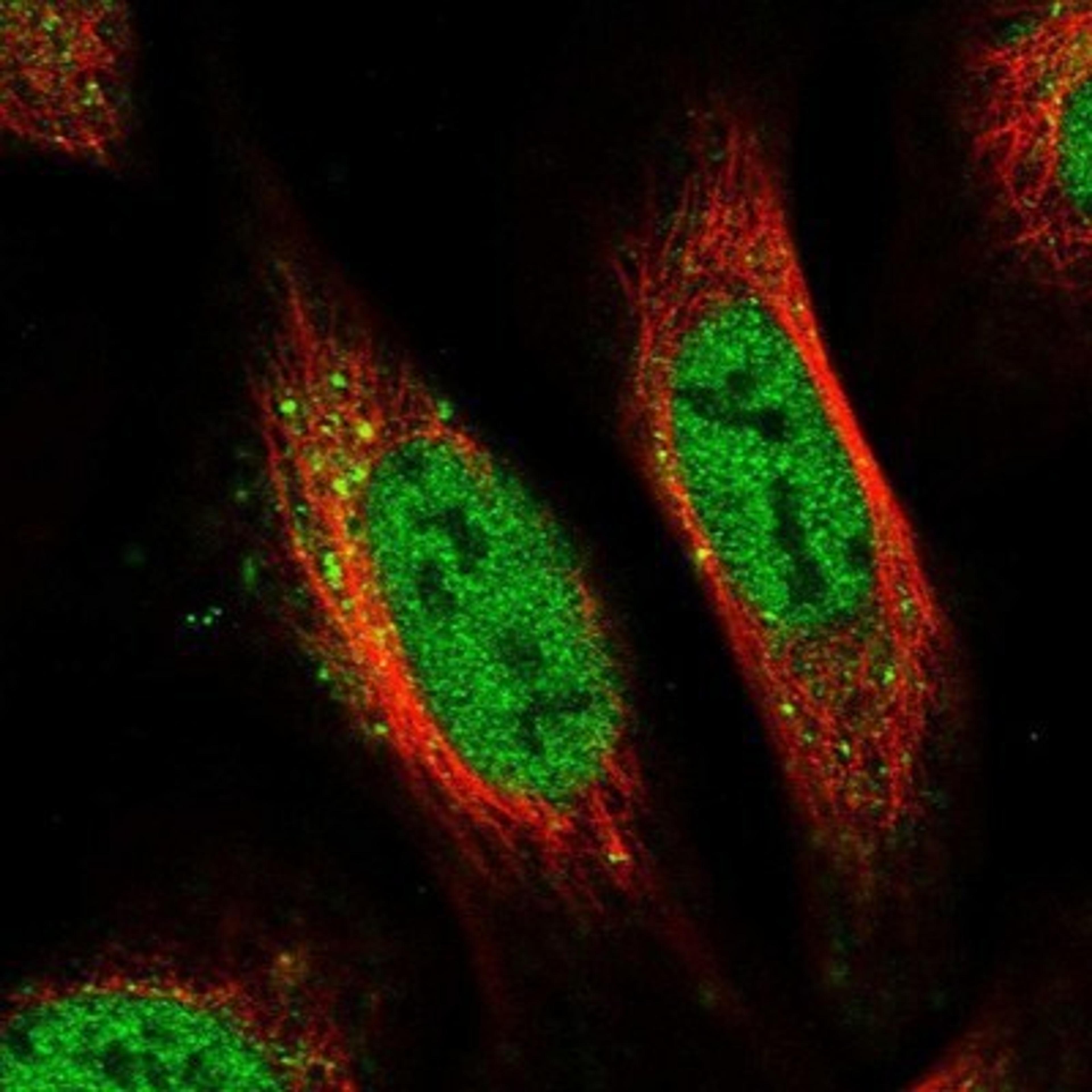 Immunocytochemistry/Immunofluorescence: PRCC Antibody [NBP1-87153] - Staining of human cell line U-2 OS shows positivity in nucleus but not nucleoli & vesicles.