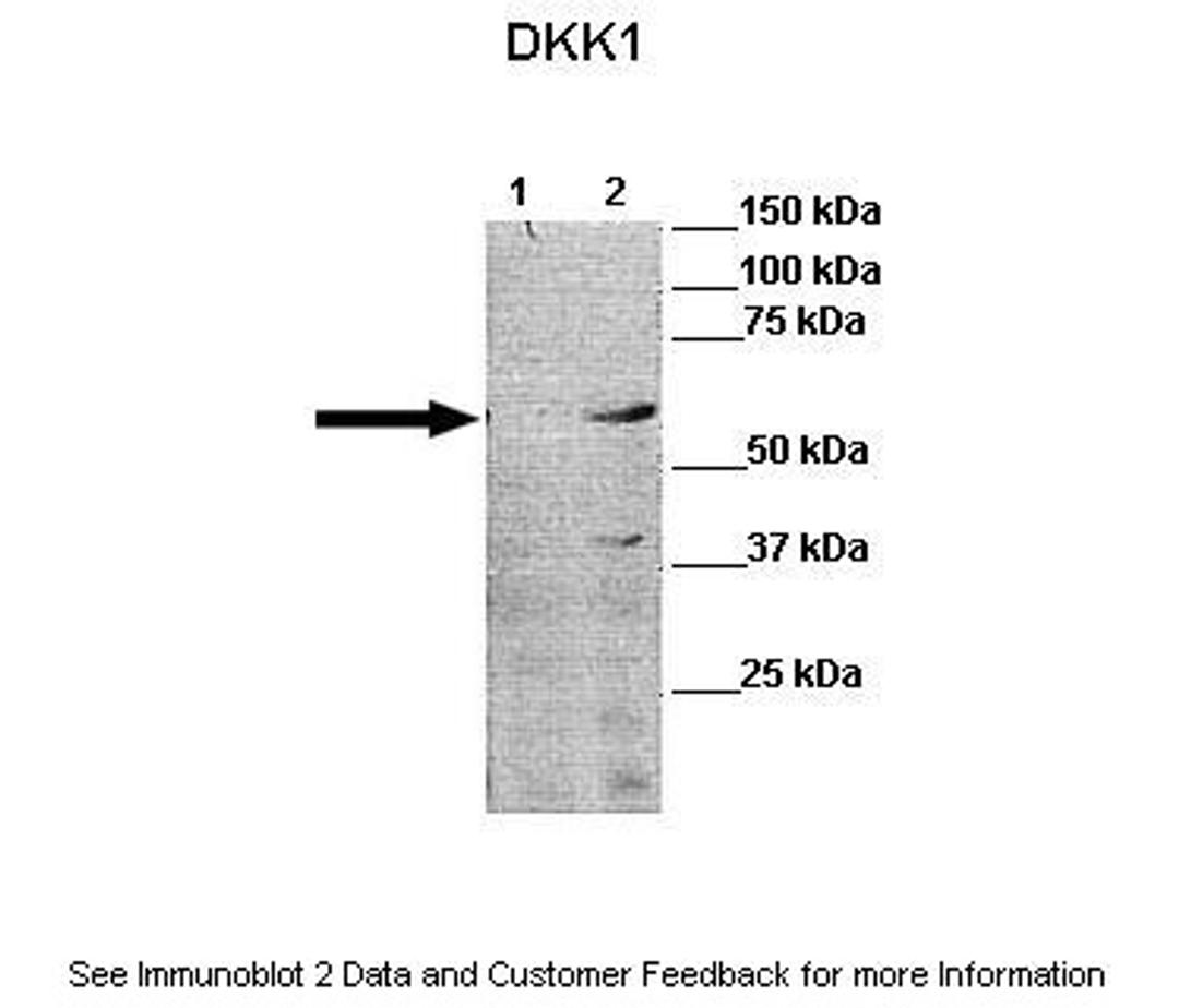 Antibody used in WB on Human cell lines at: 1:1000 (Lane 1: 30ug human PLC/PRF5 cell lysate, Lane 2: 30ug DKK1 PLC/PRF5 cell lysate ).