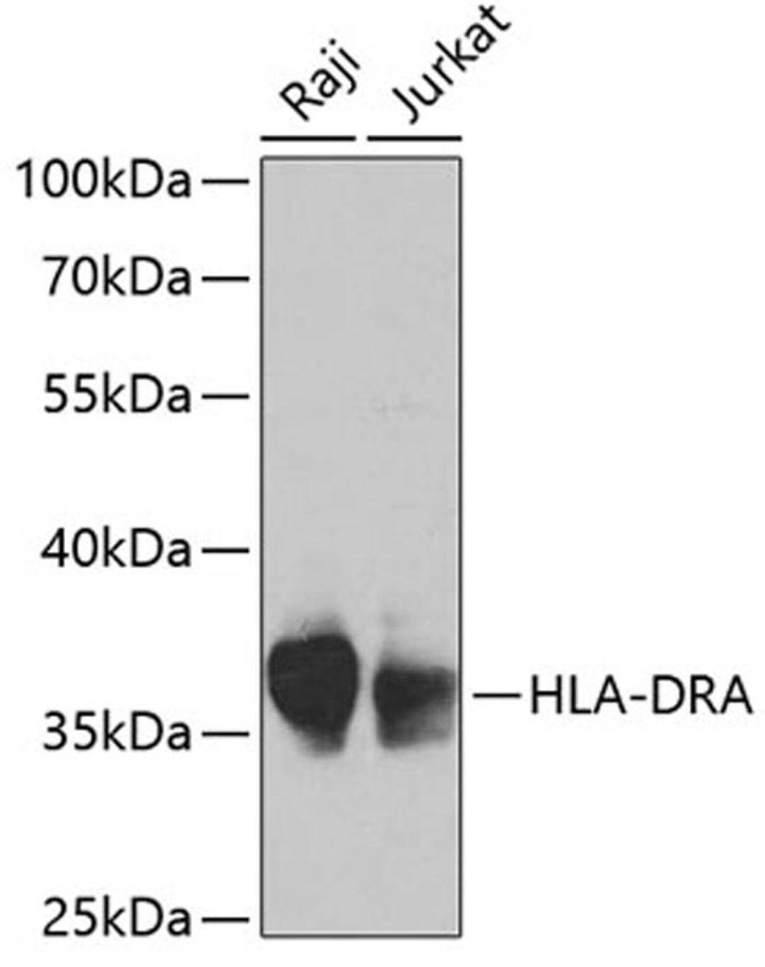 Western blot - HLA-DRA antibody (A1579)