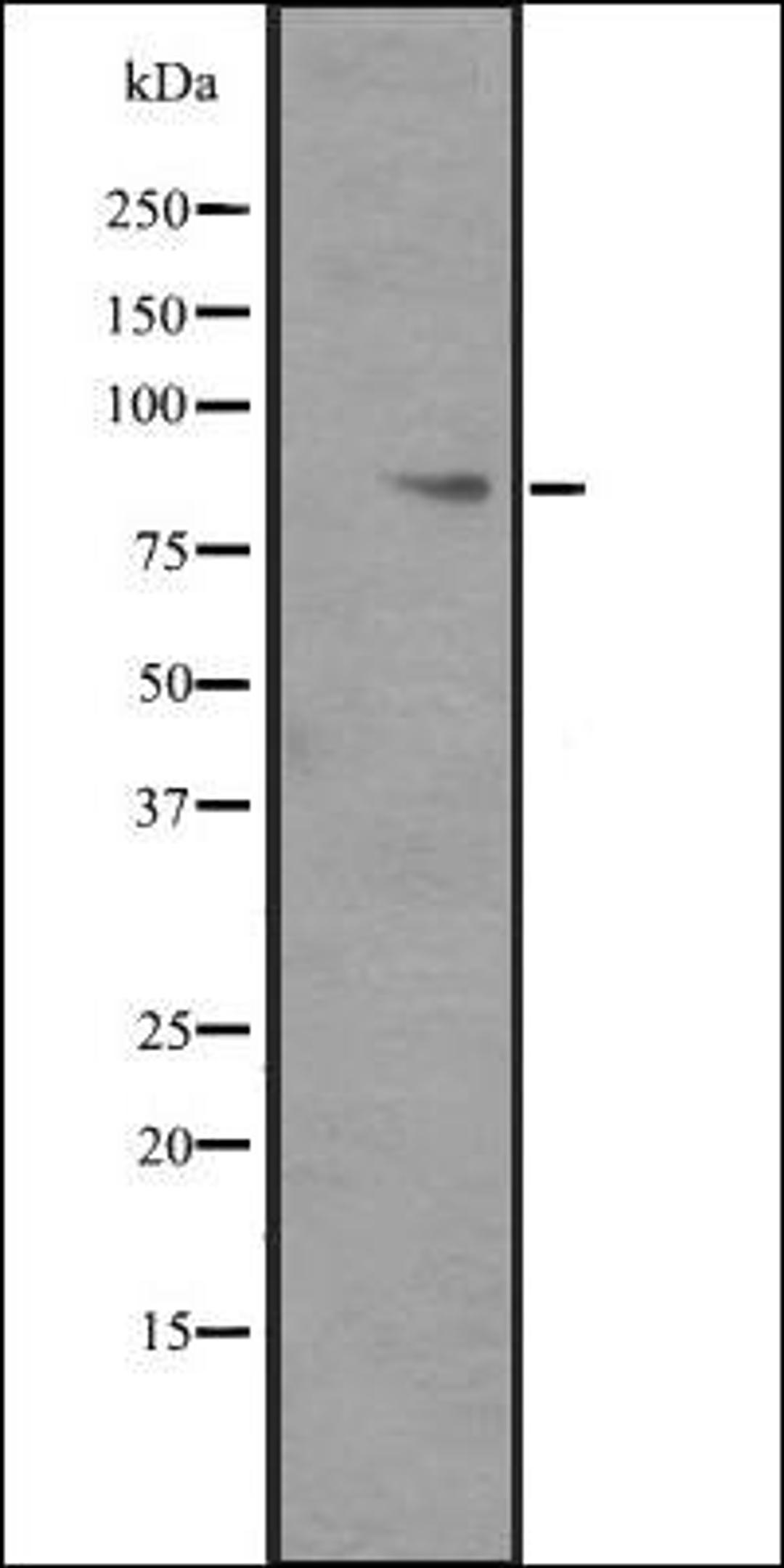 Western blot analysis of ITGB6 transfected 293T cell lysate using ITGB6 antibody