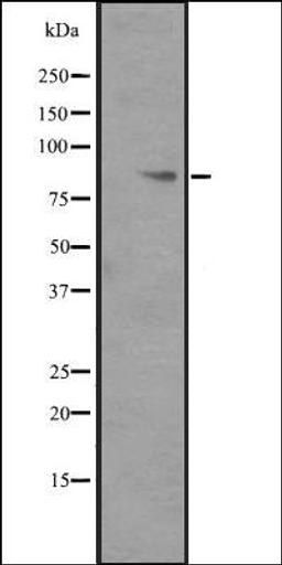 Western blot analysis of ITGB6 transfected 293T cell lysate using ITGB6 antibody