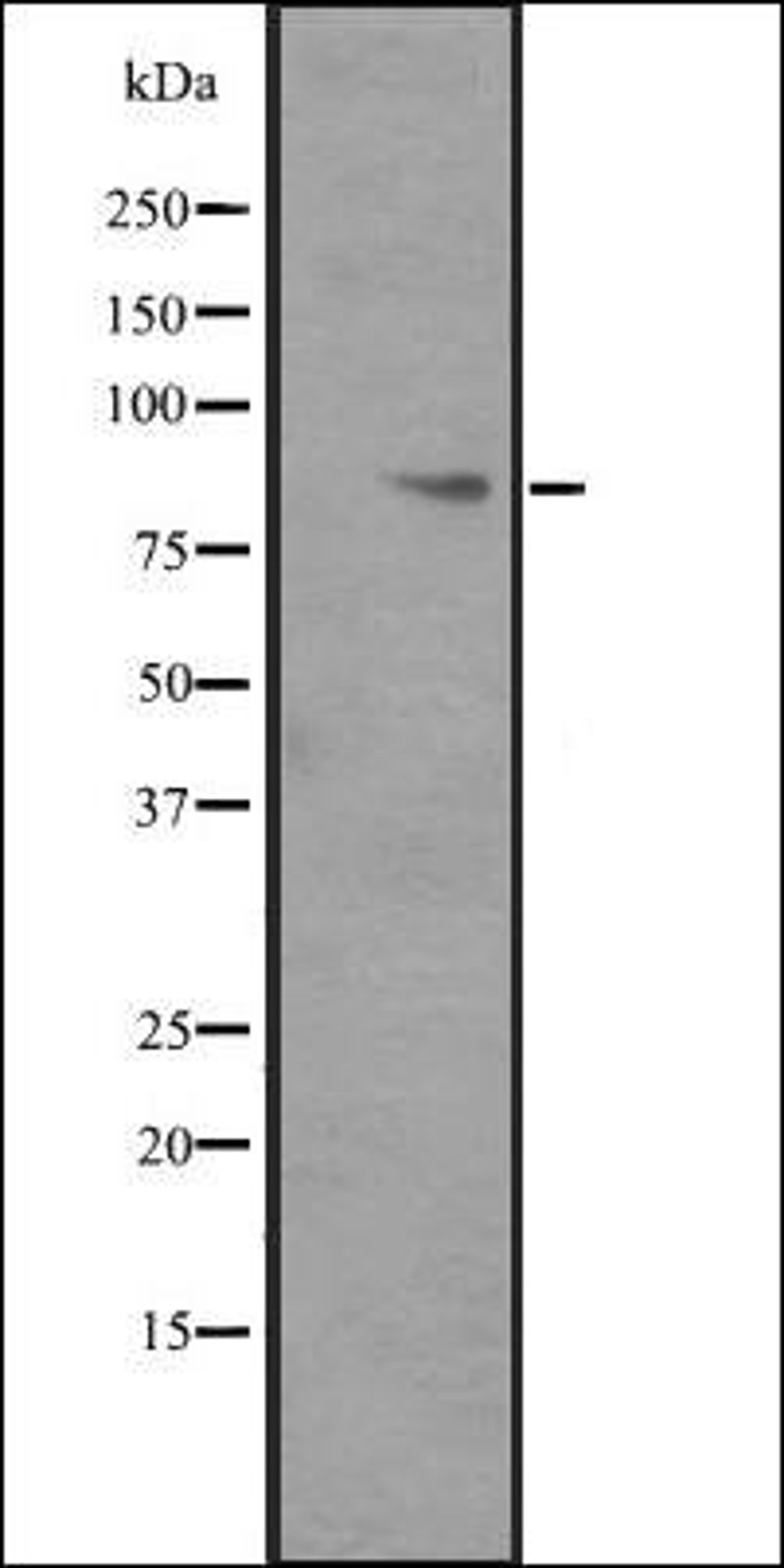 Western blot analysis of ITGB6 transfected 293T cell lysate using ITGB6 antibody