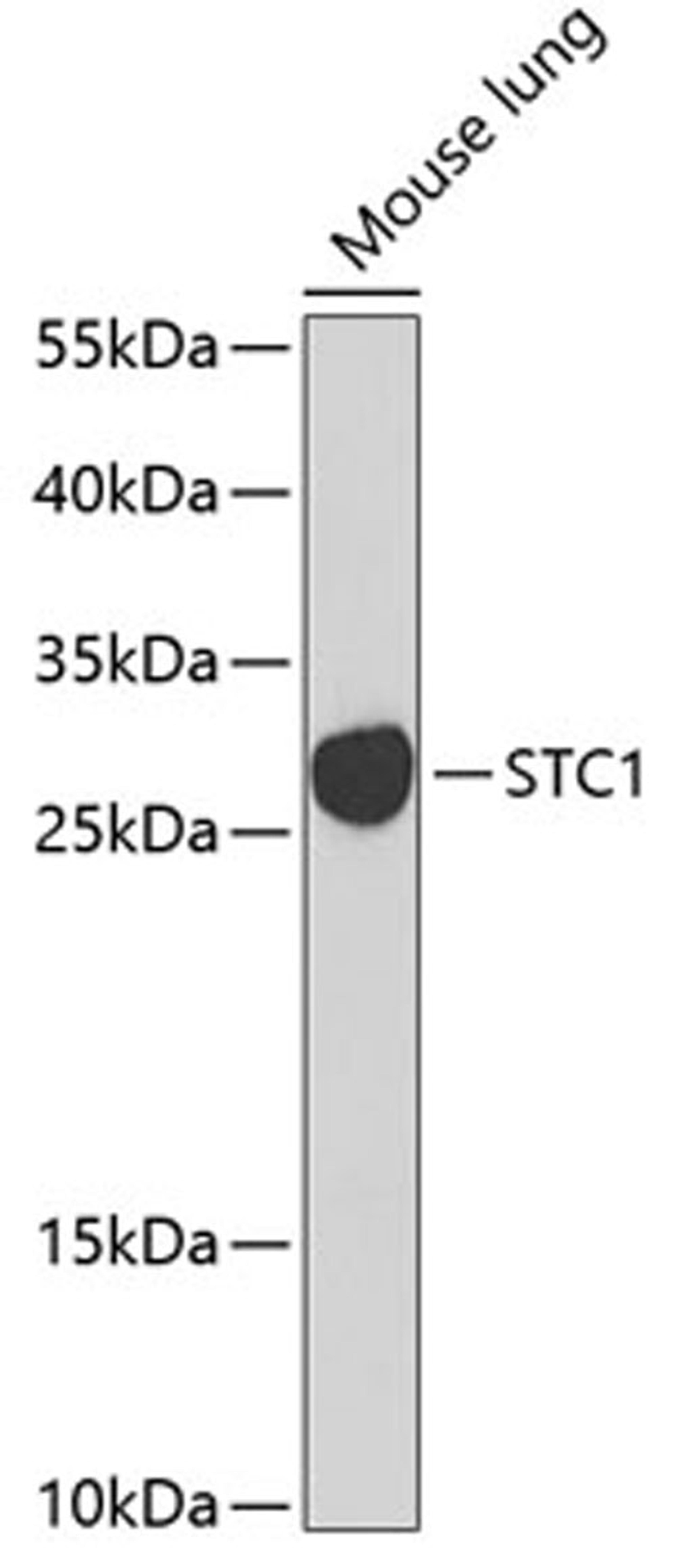 Western blot - STC1 Antibody (A6755)