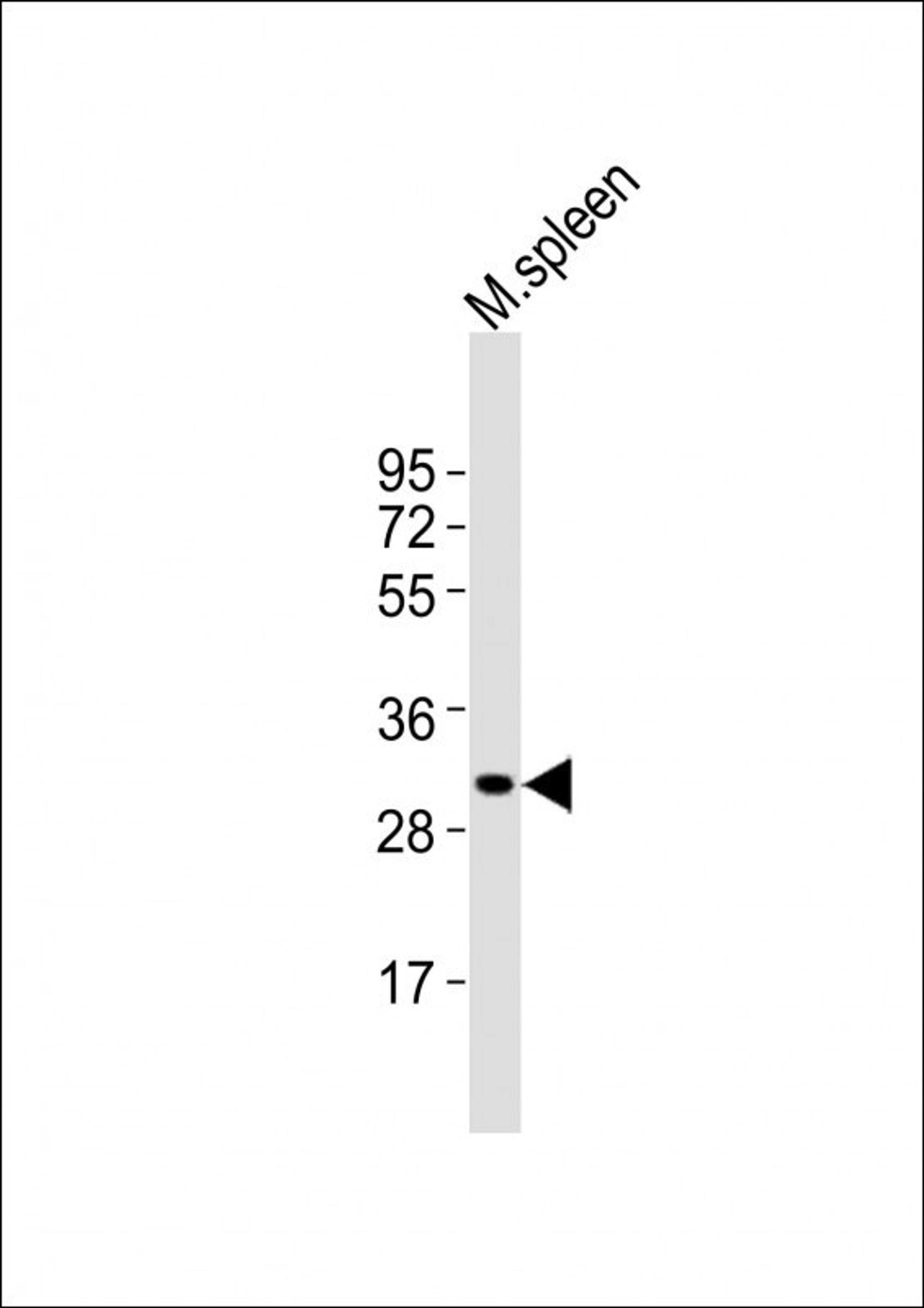 Western Blot at 1:2000 dilution + mouse spleen lysates Lysates/proteins at 20 ug per lane.