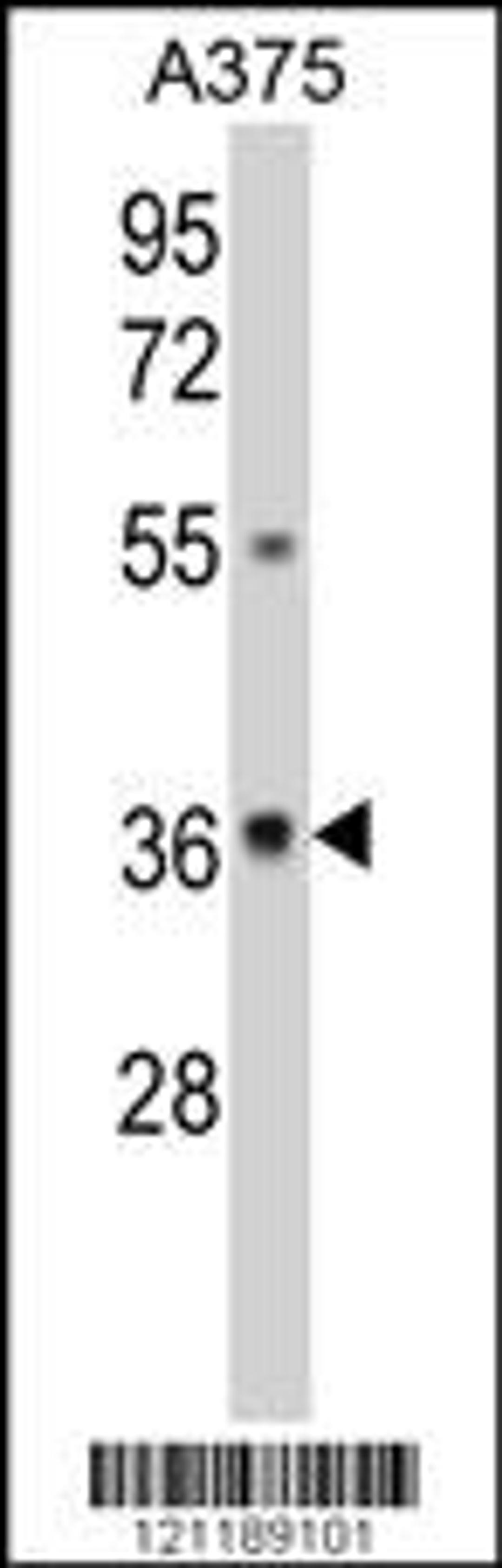 Western blot analysis of GALE Antibody in A375 cell line lysates (35ug/lane)