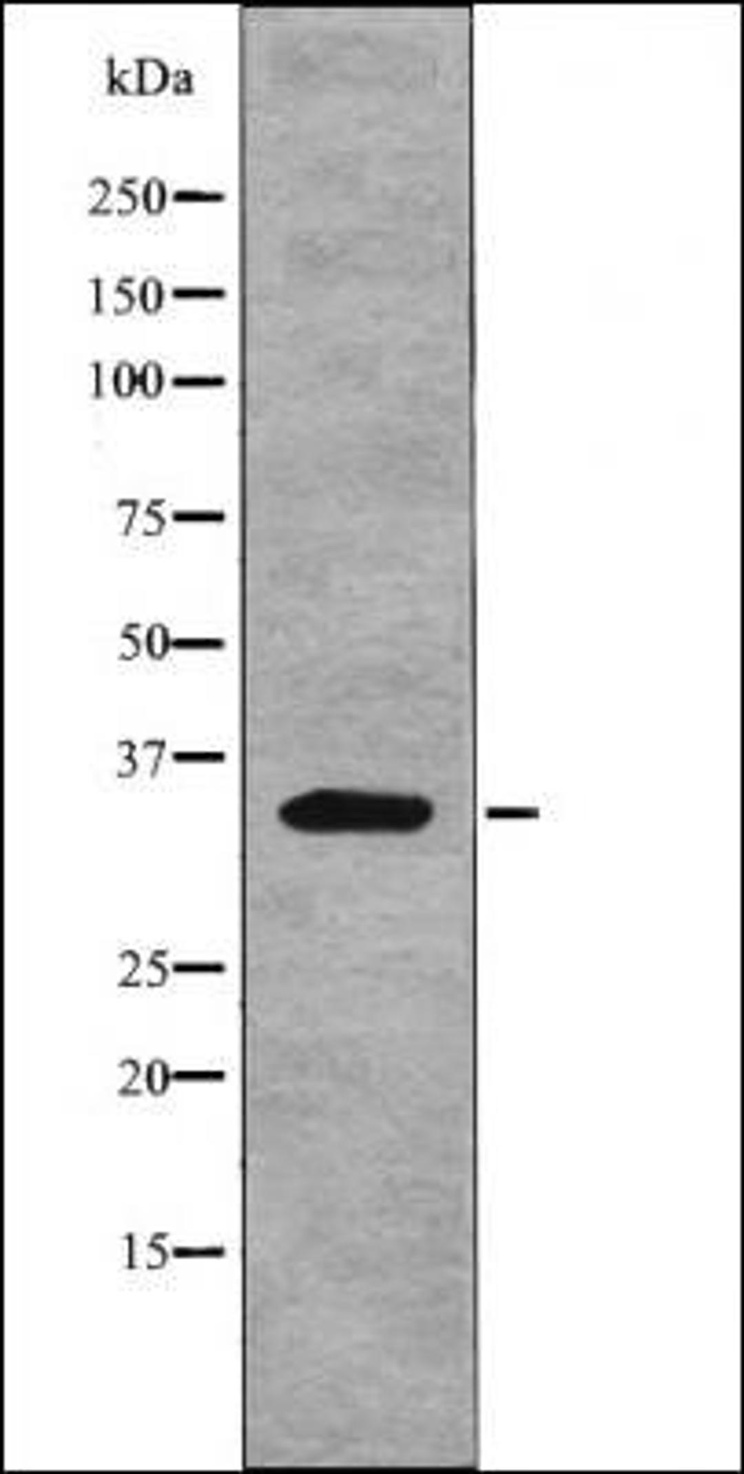 Western blot analysis of nocodazole treated HeLa whole cell lysates using Myd88 -Phospho-Tyr257- antibody