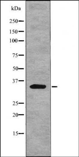 Western blot analysis of nocodazole treated HeLa whole cell lysates using Myd88 -Phospho-Tyr257- antibody