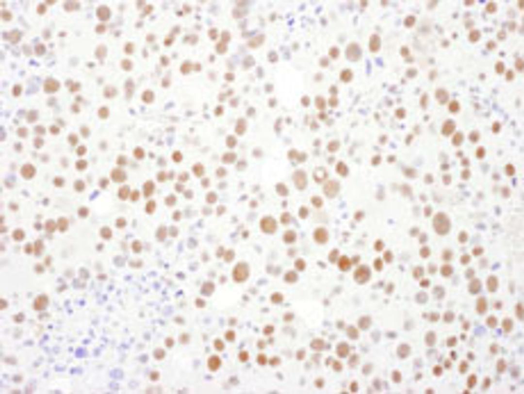 Detection of mouse PSME3 by immunohistochemistry.