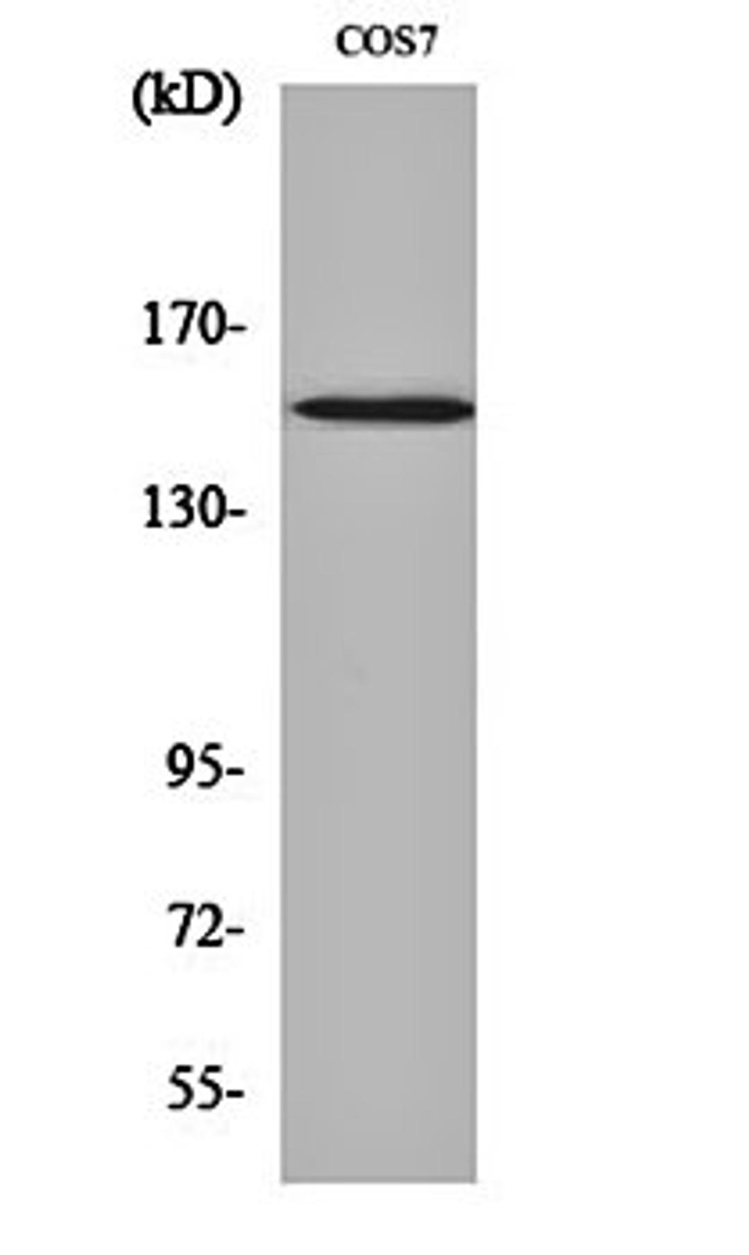 Western blot analysis of COS7 cell lysates using PLC gamma 1 (phospho-Y771) antibody