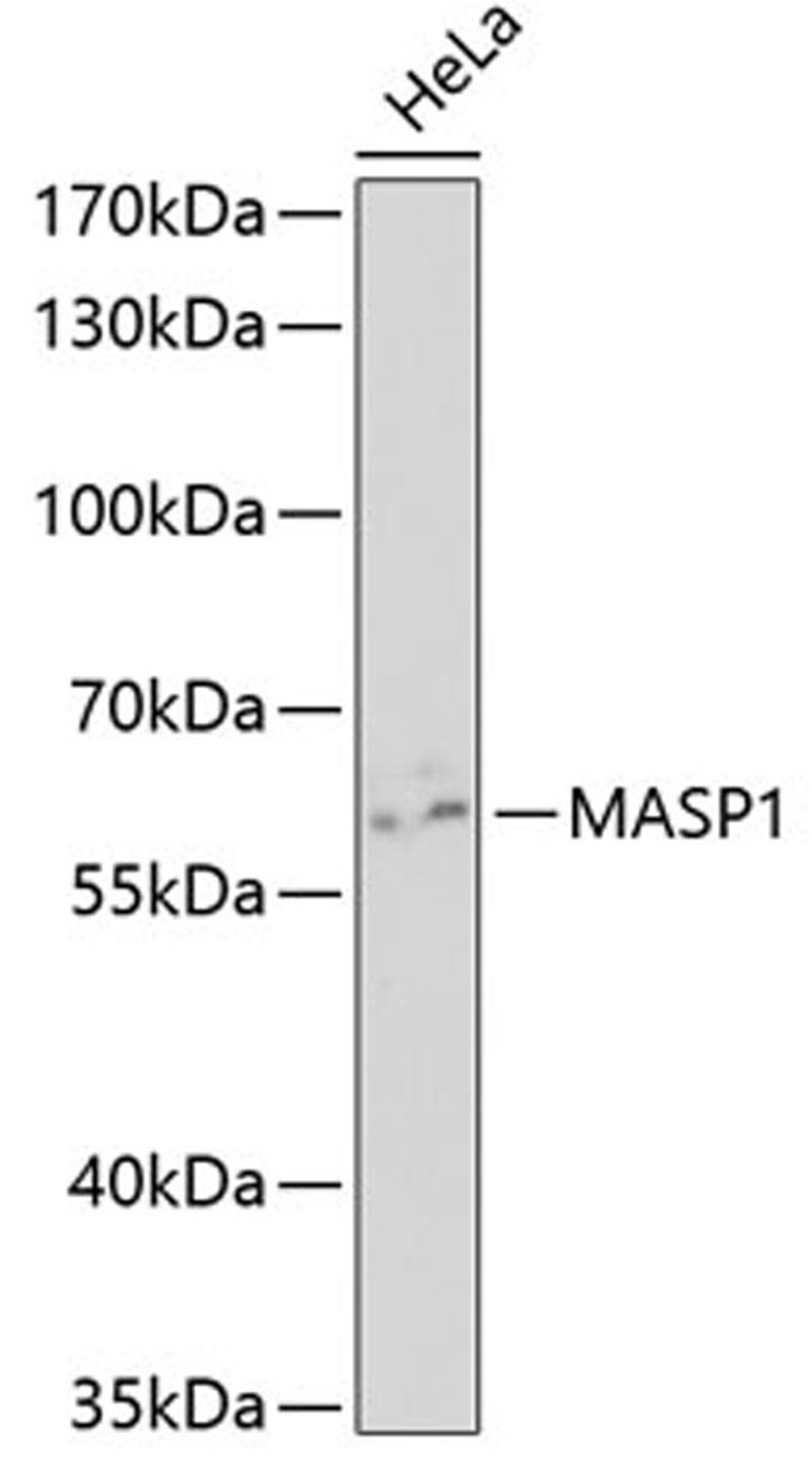 Western blot - MASP1 antibody (A5693)