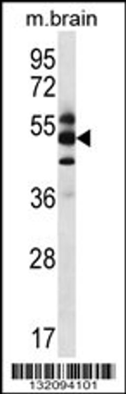 Western blot analysis in mouse brain tissue lysates (35ug/lane).