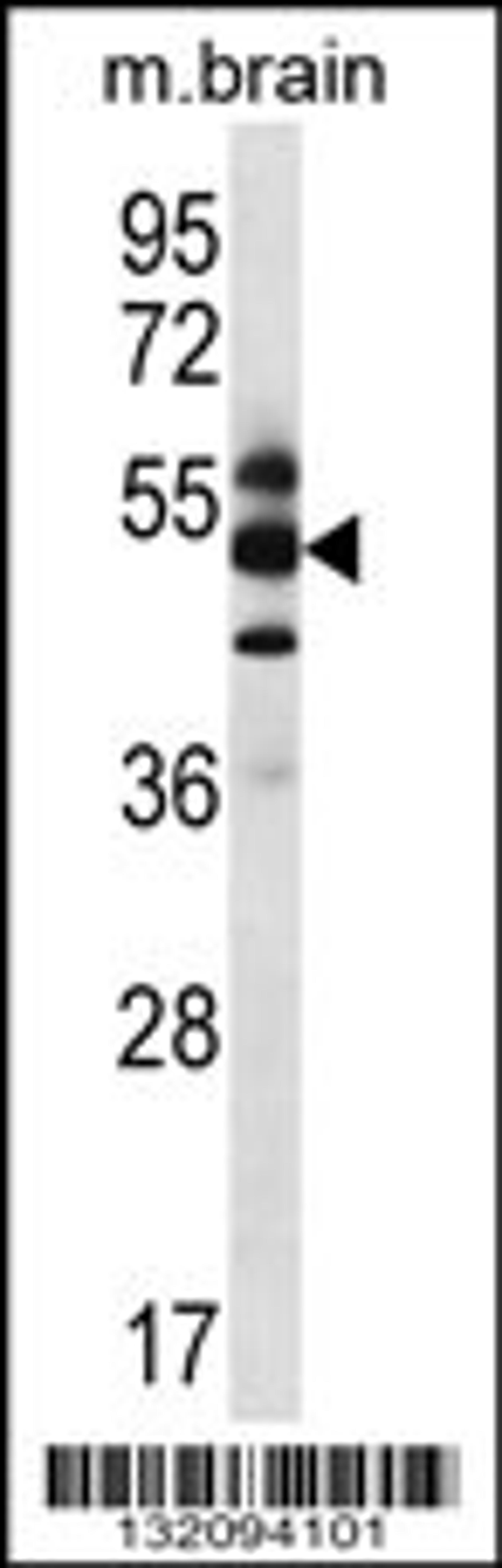 Western blot analysis in mouse brain tissue lysates (35ug/lane).