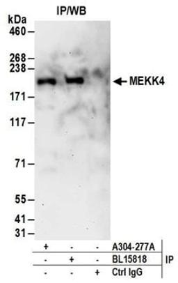 Detection of human MEKK4 by western blot of immunoprecipitates.