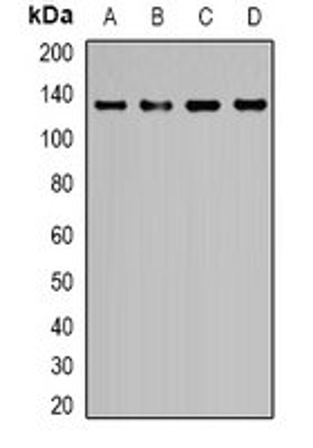 Western blot analysis of K562 (Lane1), Hela (Lane2), HEK293T (Lane3), NIH3T3 (Lane4) whole cell lysates using EGF antibody