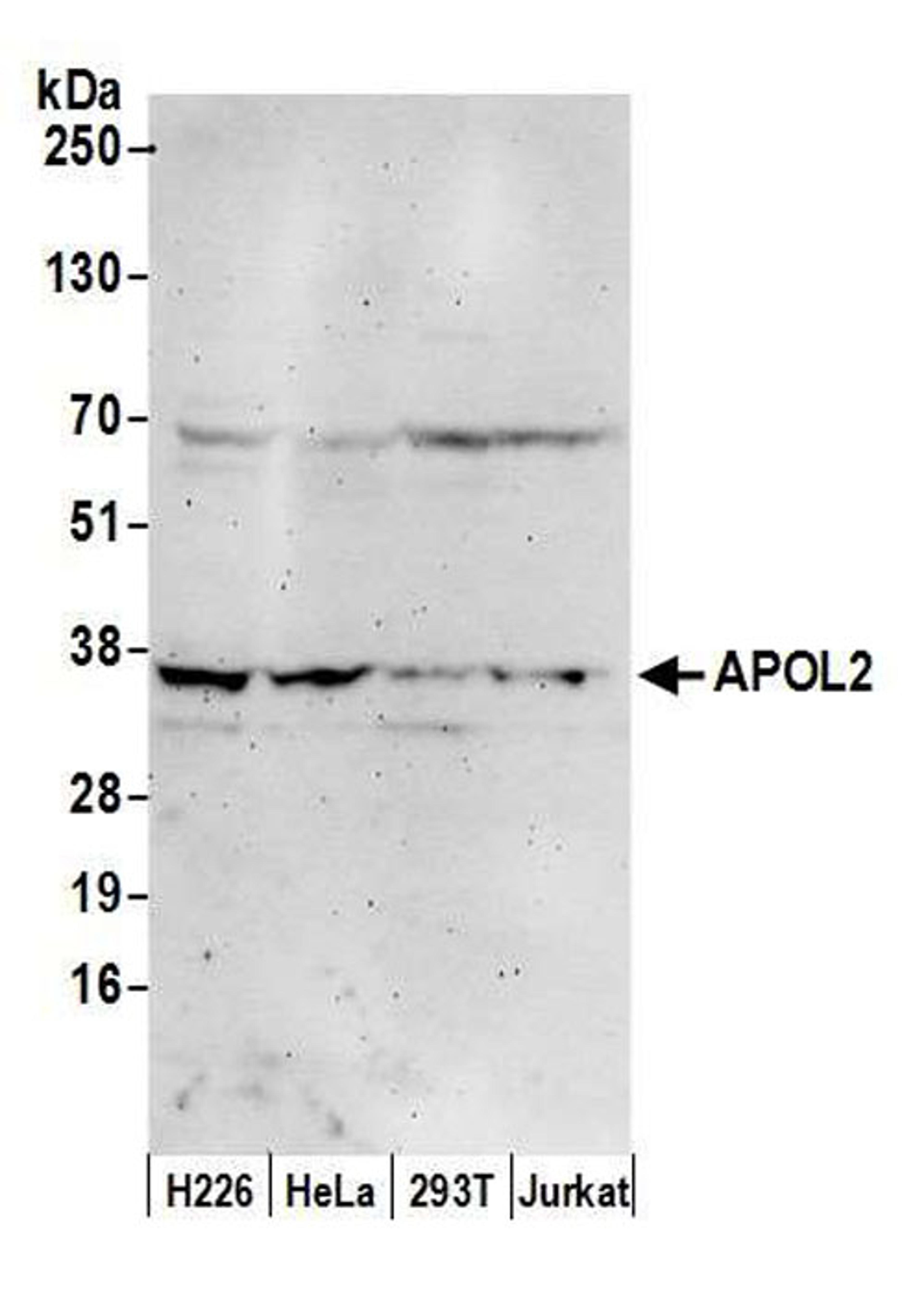 Detection of human APOL2 by WB.