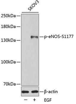 Western blot - Phospho-eNOS-S1177 antibody (AP0515)