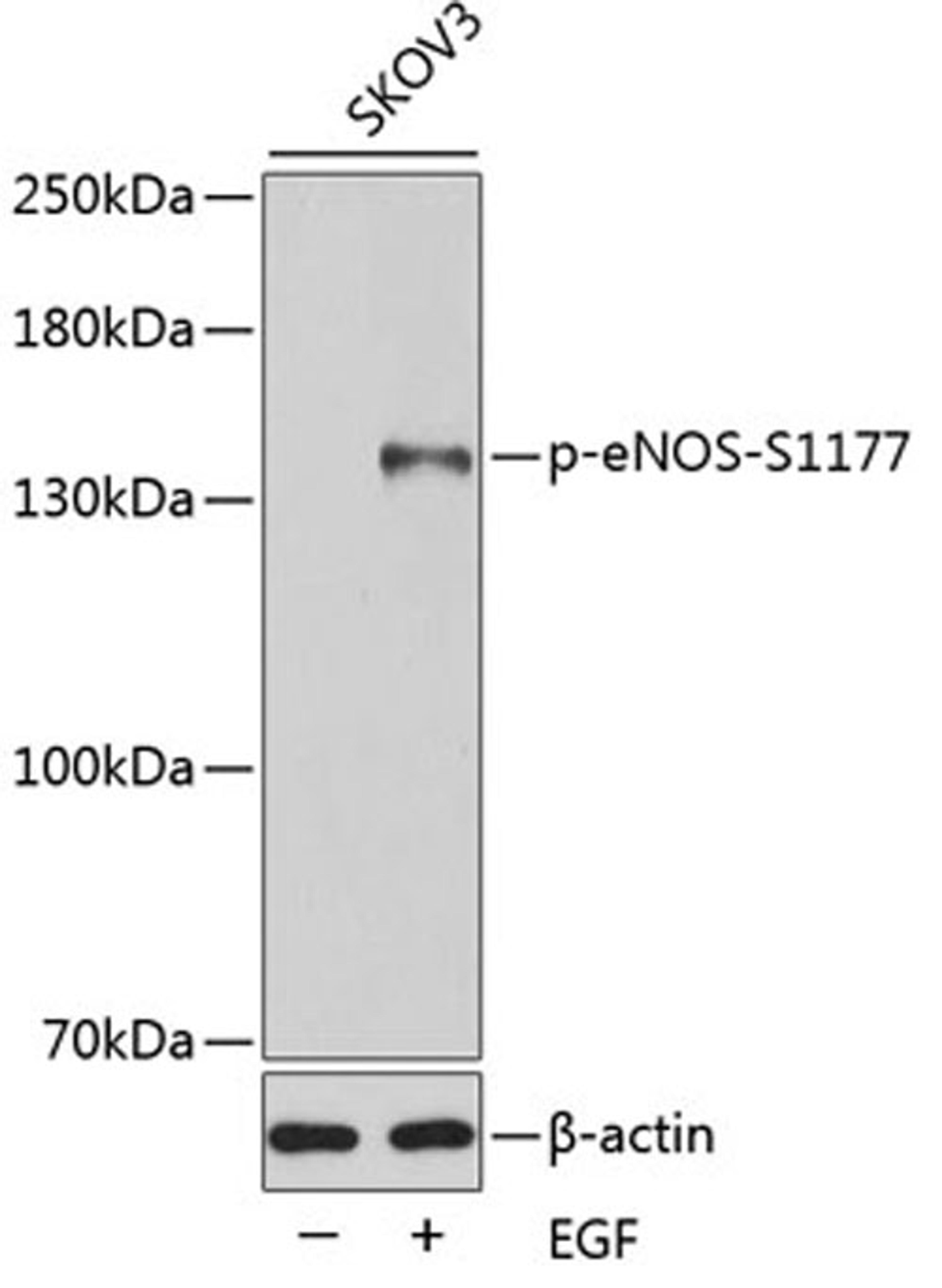 Western blot - Phospho-eNOS-S1177 antibody (AP0515)