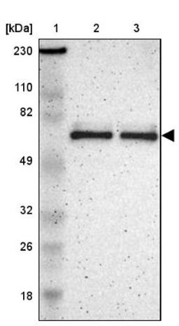 Western Blot: ZNF384 Antibody [NBP1-86675] - Lane 1: Marker [kDa] 230, 110, 82, 49, 32, 26, 18<br/>Lane 2: Human cell line RT-4<br/>Lane 3: Human cell line U-251MG sp