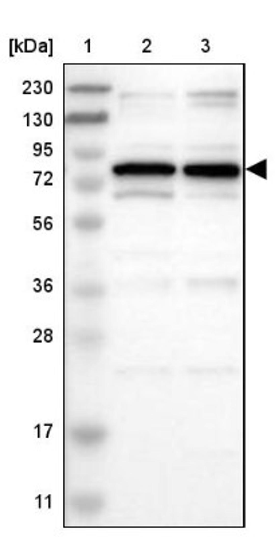 Western Blot: SETDB1 Antibody [NBP1-84790] - Lane 1: Marker [kDa] 230, 130, 95, 72, 56, 36, 28, 17, 11<br/>Lane 2: Human cell line RT-4<br/>Lane 3: Human cell line U-251MG