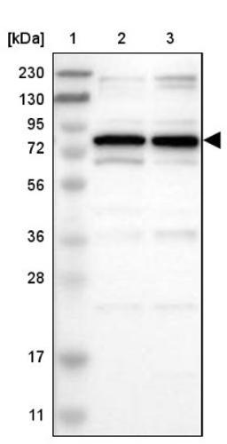 Western Blot: SETDB1 Antibody [NBP1-84790] - Lane 1: Marker [kDa] 230, 130, 95, 72, 56, 36, 28, 17, 11<br/>Lane 2: Human cell line RT-4<br/>Lane 3: Human cell line U-251MG