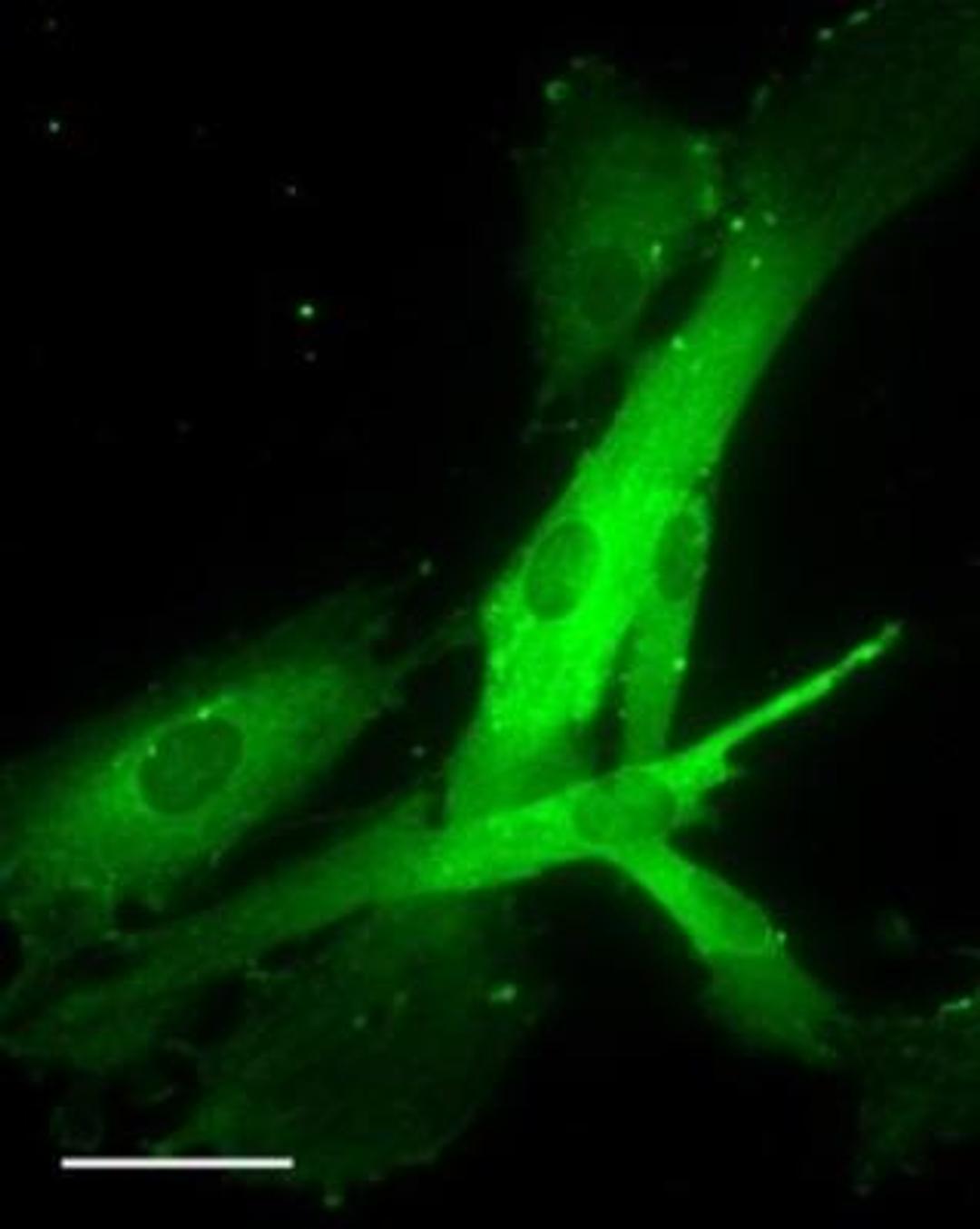 Immunocytochemistry/Immunofluorescence: OXTR Antibody [NBP1-28487] - Staining of Human Prostate stromal cells. Overnight incubation at 4C and detected with Alexafluor secondary conjugated antibody.