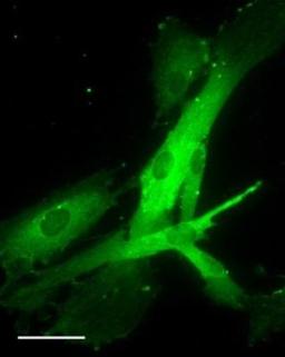 Immunocytochemistry/Immunofluorescence: OXTR Antibody [NBP1-28487] - Staining of Human Prostate stromal cells. Overnight incubation at 4C and detected with Alexafluor secondary conjugated antibody.