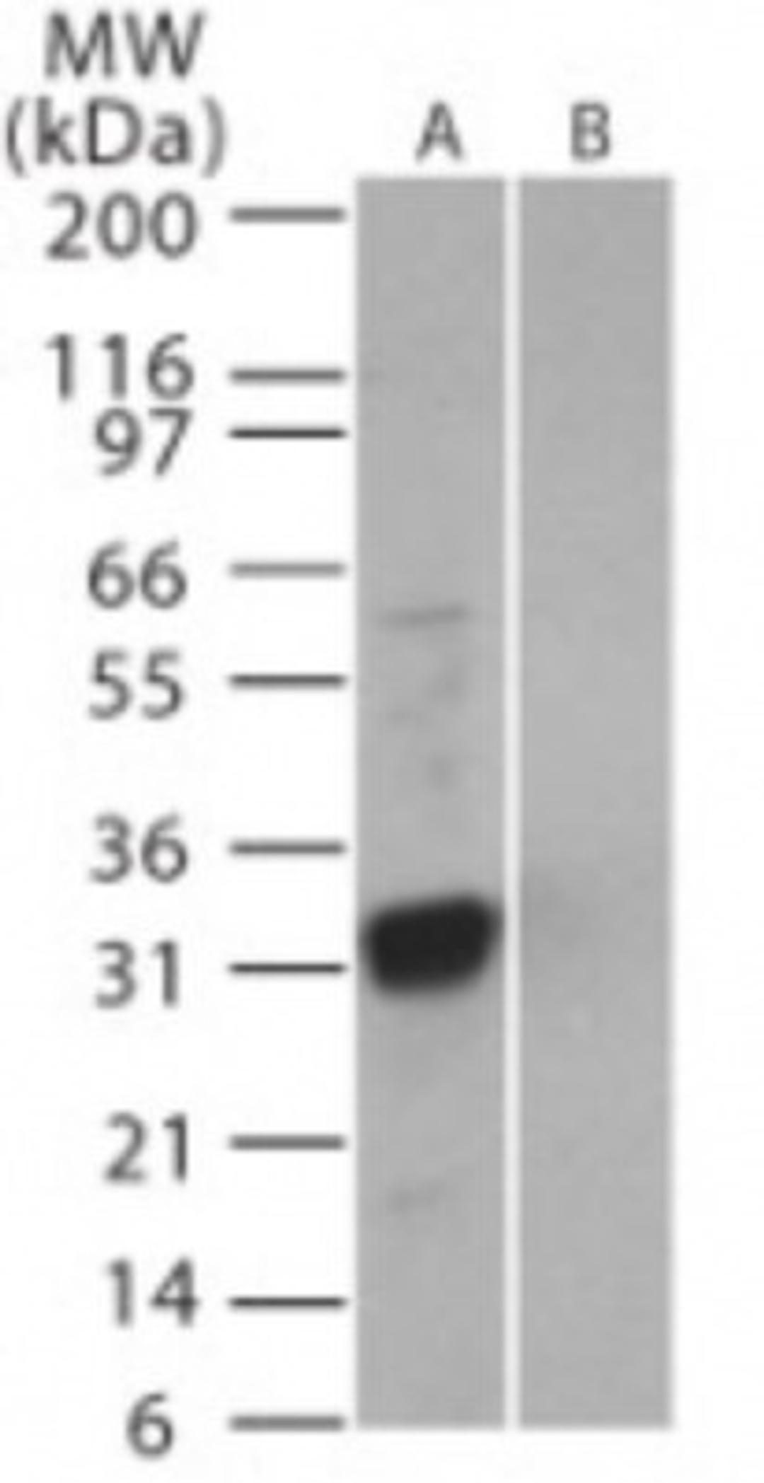 Western Blot: SARS 3b Antibody [NB100-56746] - Analysis of SARS-3b in (A) recombinant fusion protein containing amino acids 31-45 and (B) fusion partner without these amino acids, using this antibody at 0.5 ug/ml.