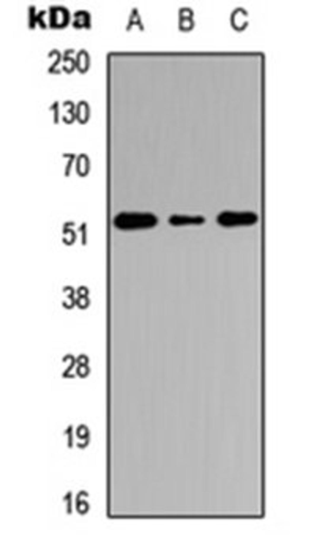 Western blot analysis of HEK293T (Lane 1), Raw264.7 (Lane 2), PC12 (Lane 3) whole cell lysates using Cathepsin C HC antibody