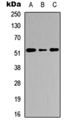 Western blot analysis of HEK293T (Lane 1), Raw264.7 (Lane 2), PC12 (Lane 3) whole cell lysates using Cathepsin C HC antibody