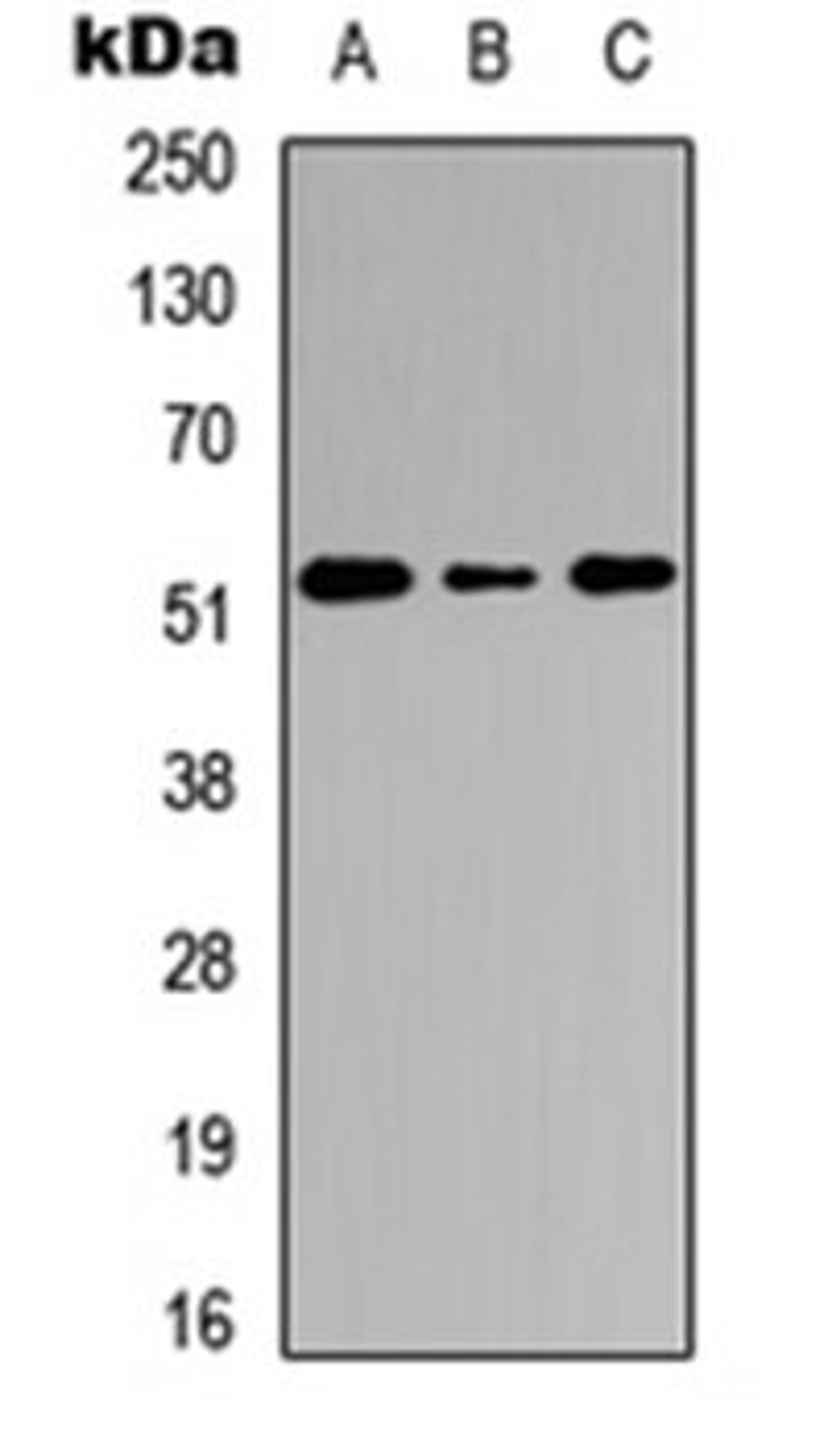Western blot analysis of HEK293T (Lane 1), Raw264.7 (Lane 2), PC12 (Lane 3) whole cell lysates using Cathepsin C HC antibody