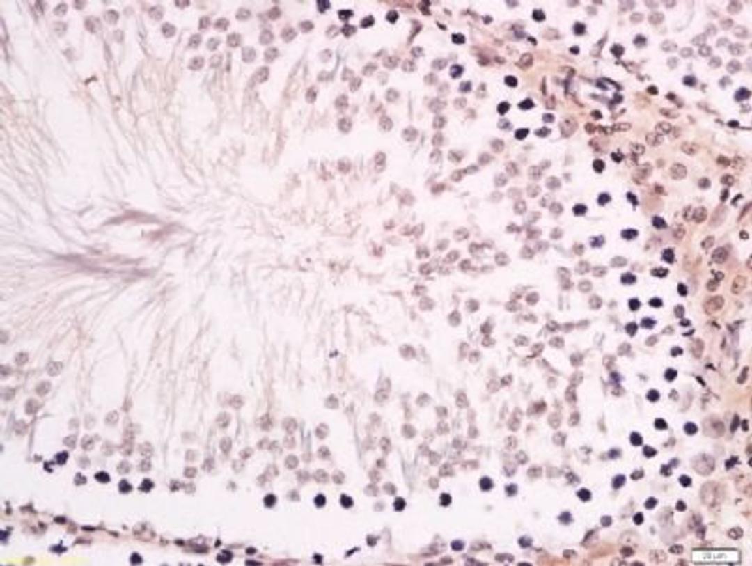 Immunohistochemical staining of rat testis tissue using ZNF516 antibody.