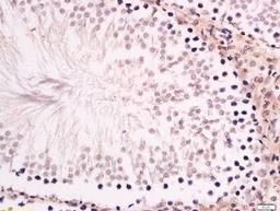 Immunohistochemical staining of rat testis tissue using ZNF516 antibody.