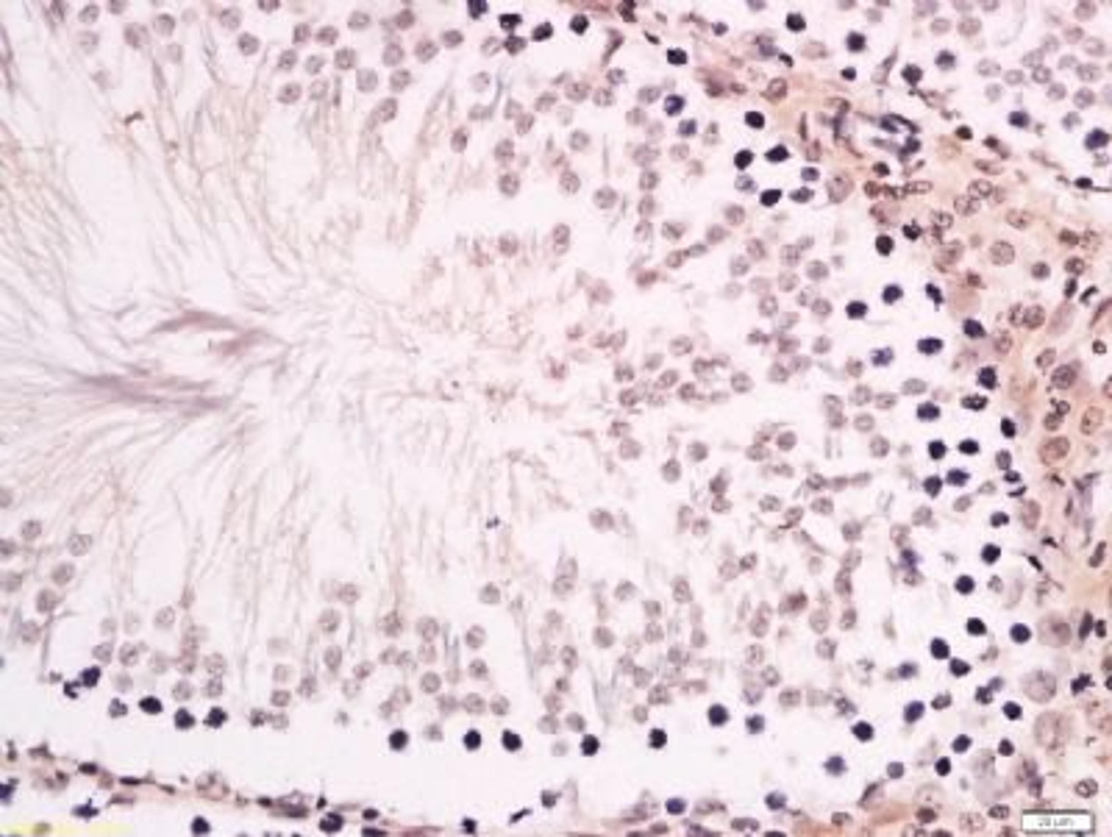 Immunohistochemical staining of rat testis tissue using ZNF516 antibody.