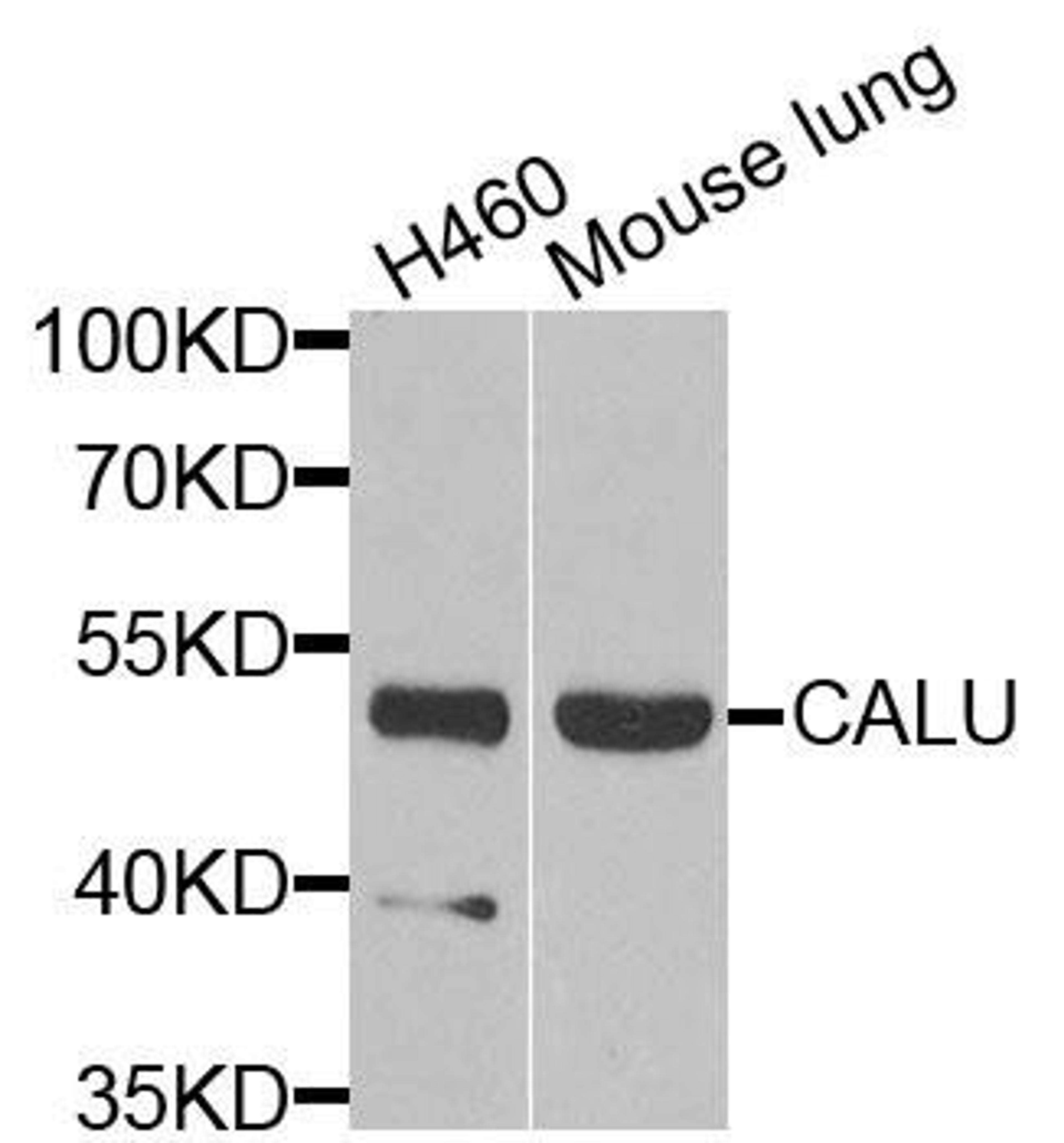 Western blot analysis of extracts of various cells using CALU antibody