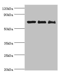 Western blot. All lanes: CD6 antibody at 4ug/ml. Lane 1: Hela whole cell lysate. Lane 2: Jurkat whole cell lysate. Lane 3: HT-29 whole cell lysate. Secondary. Goat polyclonal to rabbit IgG at 1/10000 dilution. Predicted band size: 72, 69, 64, 65, 59, 61 kDa. Observed band size: 72 kDa. 