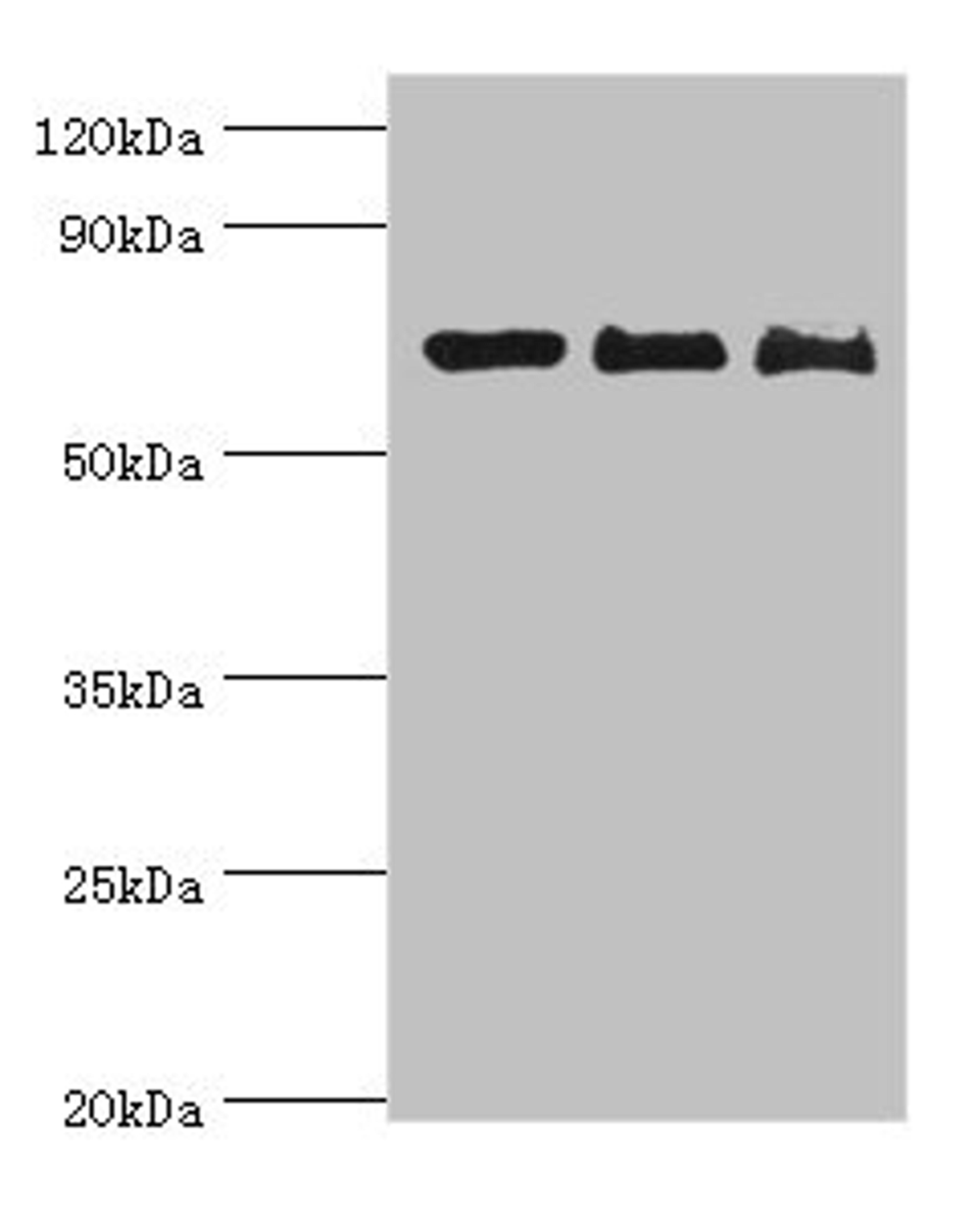Western blot. All lanes: CD6 antibody at 4ug/ml. Lane 1: Hela whole cell lysate. Lane 2: Jurkat whole cell lysate. Lane 3: HT-29 whole cell lysate. Secondary. Goat polyclonal to rabbit IgG at 1/10000 dilution. Predicted band size: 72, 69, 64, 65, 59, 61 kDa. Observed band size: 72 kDa. 