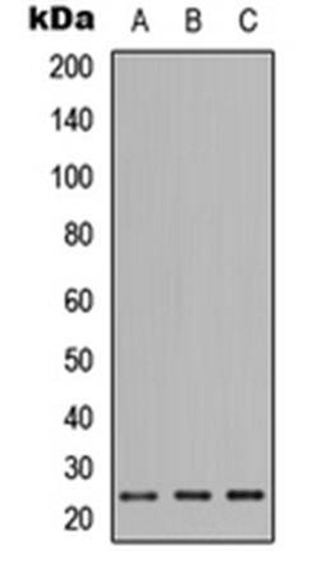 Western blot analysis of HEK293T (Lane1), Raw264.7 (Lane2), H9C2 (Lane3) whole cell using PIGF antibody