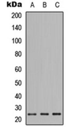 Western blot analysis of HEK293T (Lane1), Raw264.7 (Lane2), H9C2 (Lane3) whole cell using PIGF antibody